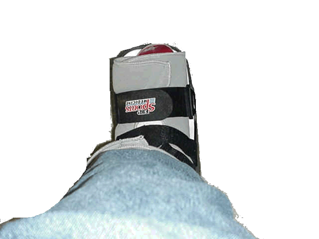 Steve's foot as of 2:00 Friday the 9th